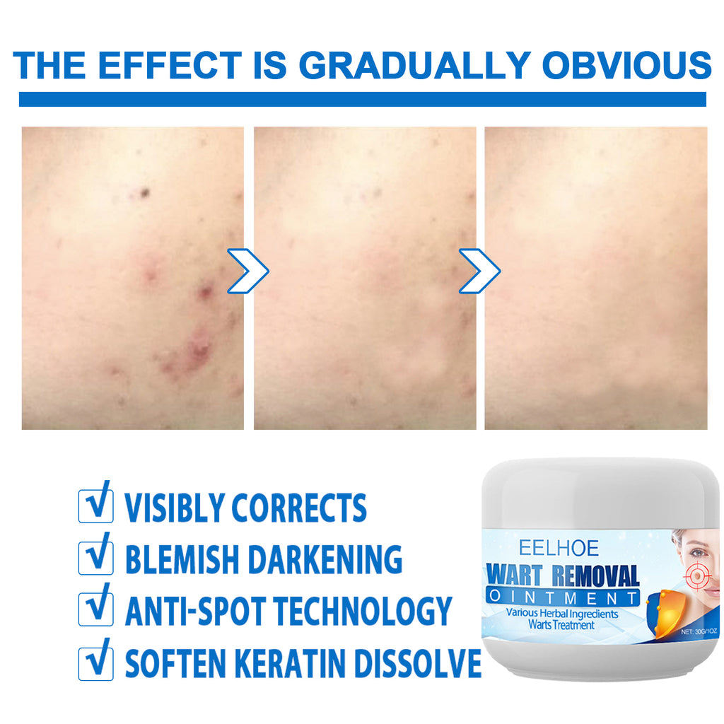 Eelhoe Repair & Moisturize Body Cream for Soft Skin