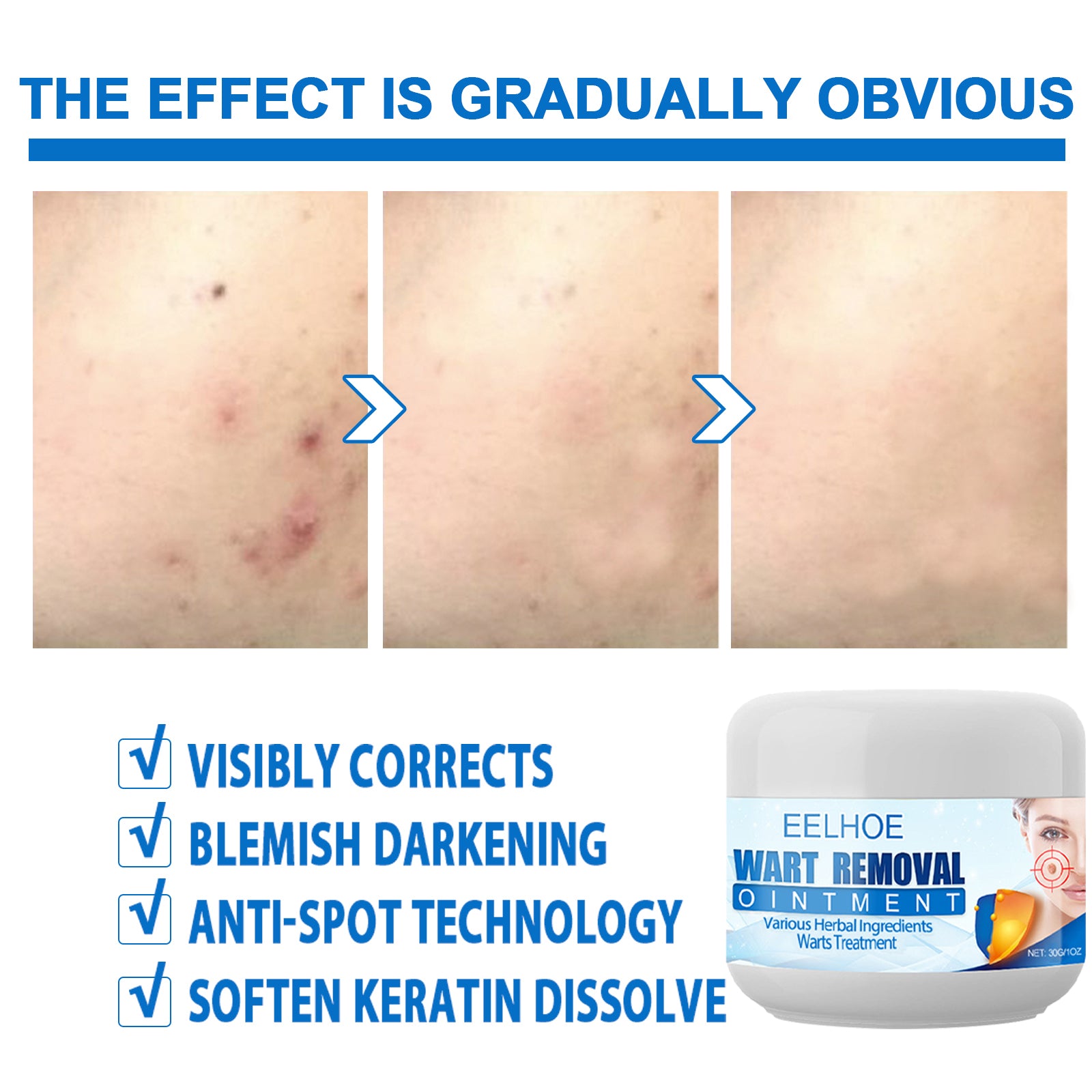 Eelhoe Repair & Moisturize Body Cream for Soft Skin